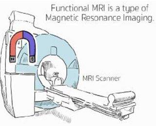 Understanding MRI: a new co-creation project to develop an animation with  research participants | UCL Queen Square Institute of Neurology - UCL –  University College London