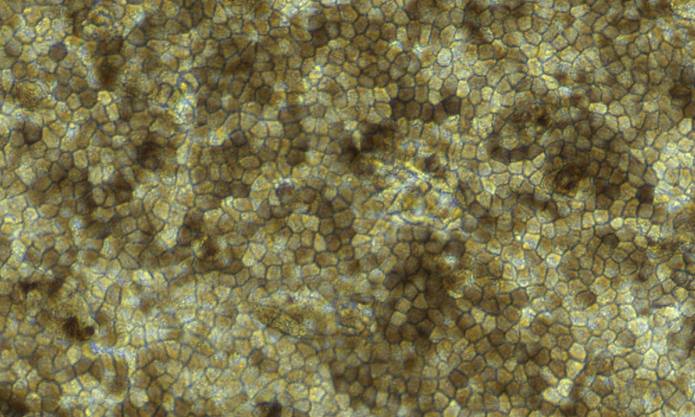 Image of Retinal Pigment Epithelium (RPE) cells at 20x magnification