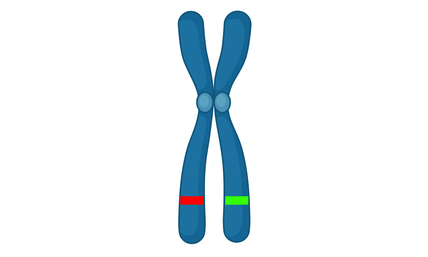Image of a chromosome with one normal copy of a gene and another defective copy.