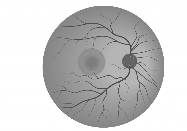 Schematic of a FAF retinal image.