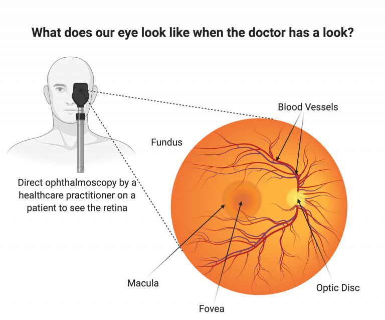 A schematic showing the anatomy of a fundus image.