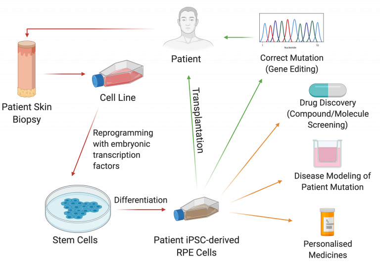 Schematic showing stem cell creation from patient skin biopsy, differentiation into RPE cells and using these RPE cells for personalised medicine, drug discovery/screening, disease modeling and mutation correction for transplantation.