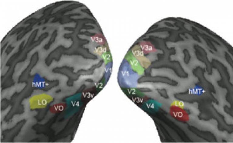 Visual areas on inflated brain…