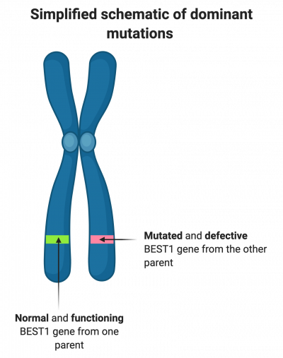 Schematic showing a pair of chromosomes. One with a green stripe to indicate a normal and functioning copy of the gene. One with a pink stripe to indicate a mutated and defective copy of the gene.