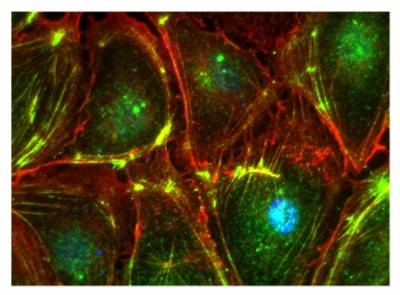 Redistribution of F-actin and active myosin from junctions to focal adhesions in ZO-1 depleted endothelial cells…