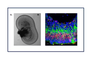 Retinal organoids exhibit a characteristic anatomical structure 