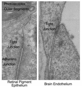 Electron micographs of retinal pigment epithelial and endothelial tight junctions…