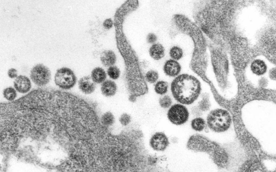 A transmission electron micrograph (TEM) of a number of Lassa virus virions adjacent to some cell debris. The virus, a member of the virus family en:Arenaviridae, causes en:Lassa fever.