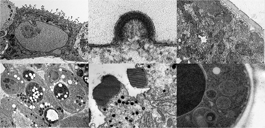 Collage of electron microscopy images