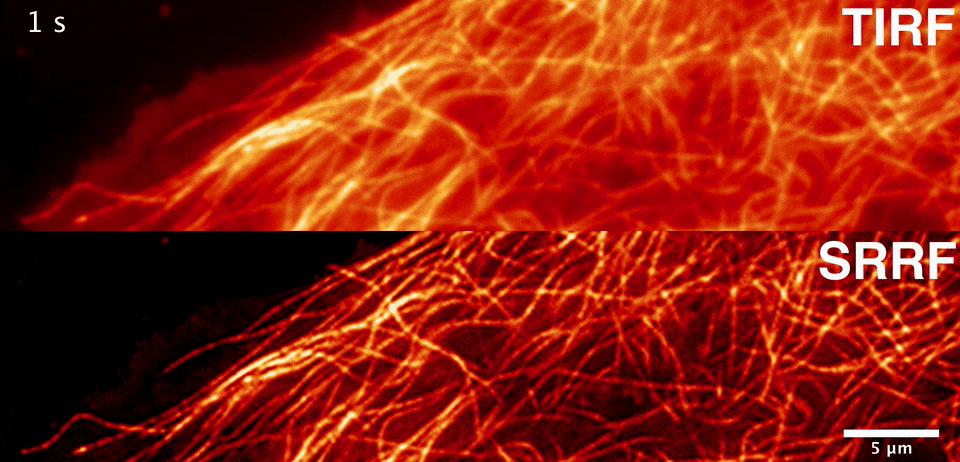 Super-resolution imaging of microtubules