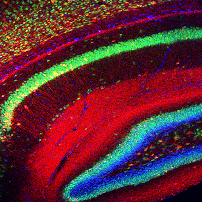 Fluorescent brain slice research image