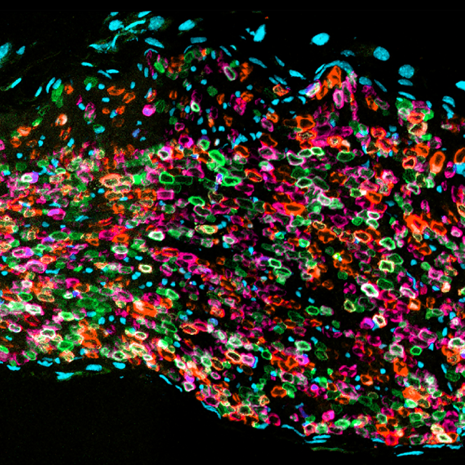 Section of sciatic nerve showing individually coloured Schwann cells