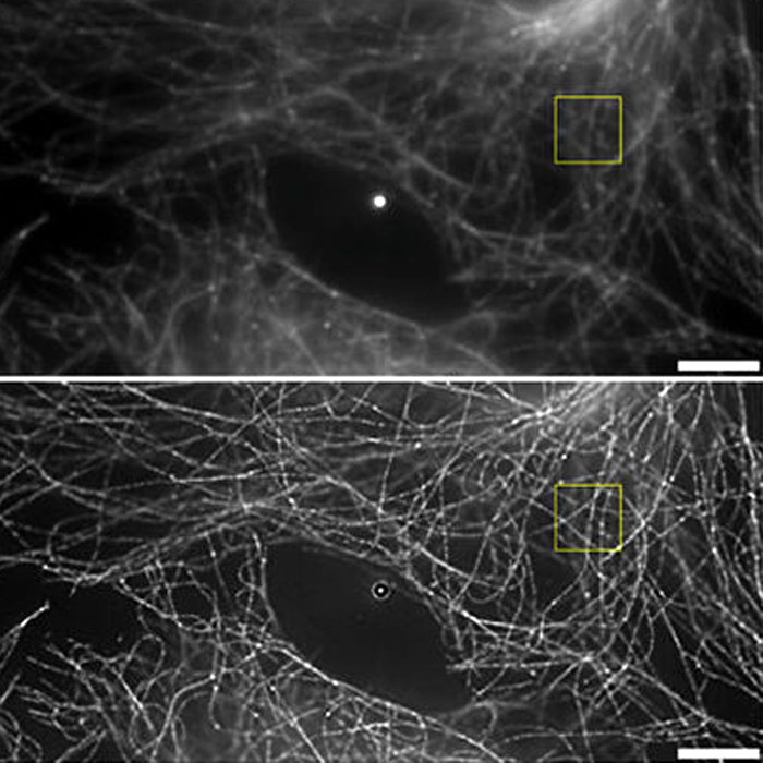 Super resolution image of microtubules