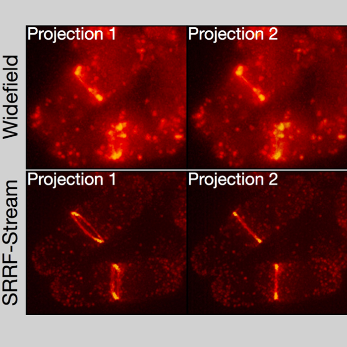 Super resolution imaging of yeast cells