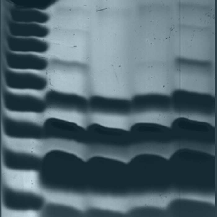cell extracts resolved by gel electrophoresis