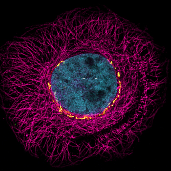 Nucleus and cytoskeleton imaged with confocal microscope 