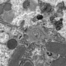 Electron microscopy image