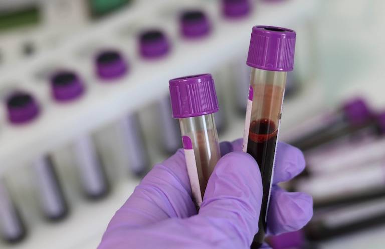 Pioneering gene therapies could mean a cure for haemophilia