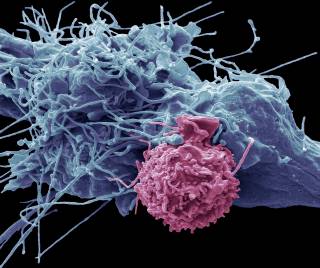 EM picture T cell attacking HCC