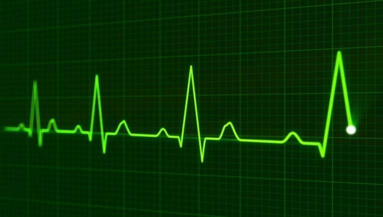 Image of Heartbeat monitor