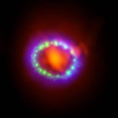 SN 1987A seen by Hubble, ALMA and Chandra