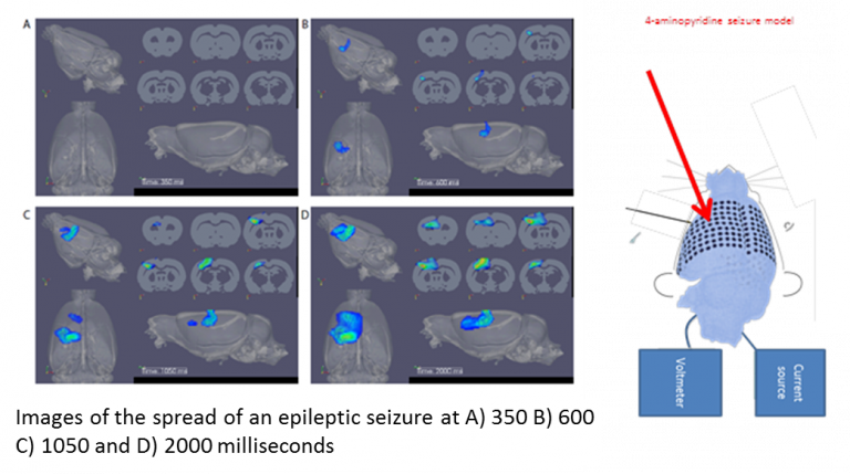 3D Fast Neural Epilepsy
