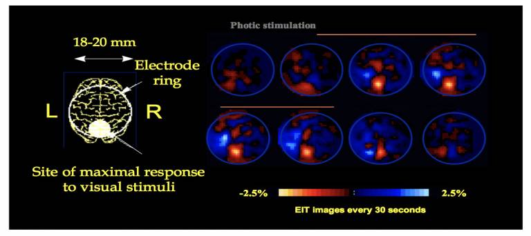 fMRI imaging from EIT group