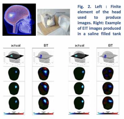 EIT image examples