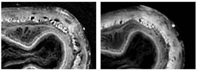 X-ray images of a rabbit oesophagus retrieved usinga single and multiple exposure