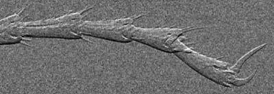 X-ray microscopy image of an insect leg