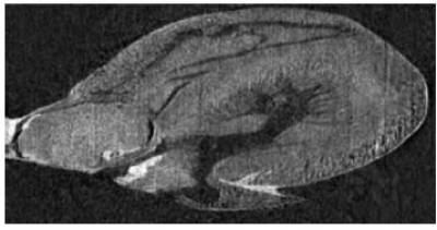 CT scan of a rat heart 