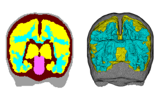 Infant brain model image