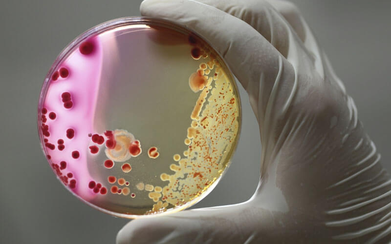 Gloved hand holding a petri dish containing cultures