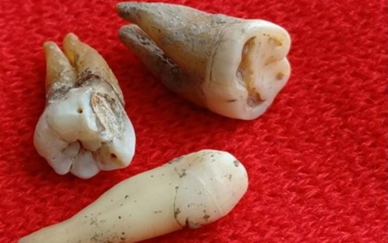 Photo of ancient teeth on display