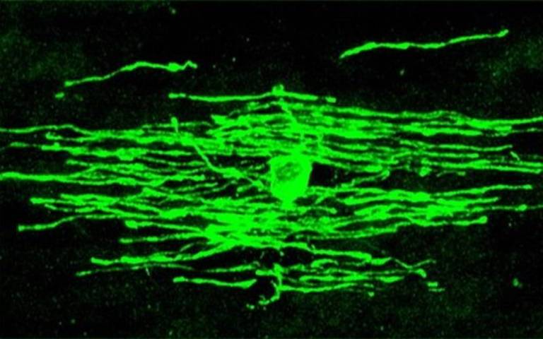 A myelinating oligodendrocyte formed in white matter during learning