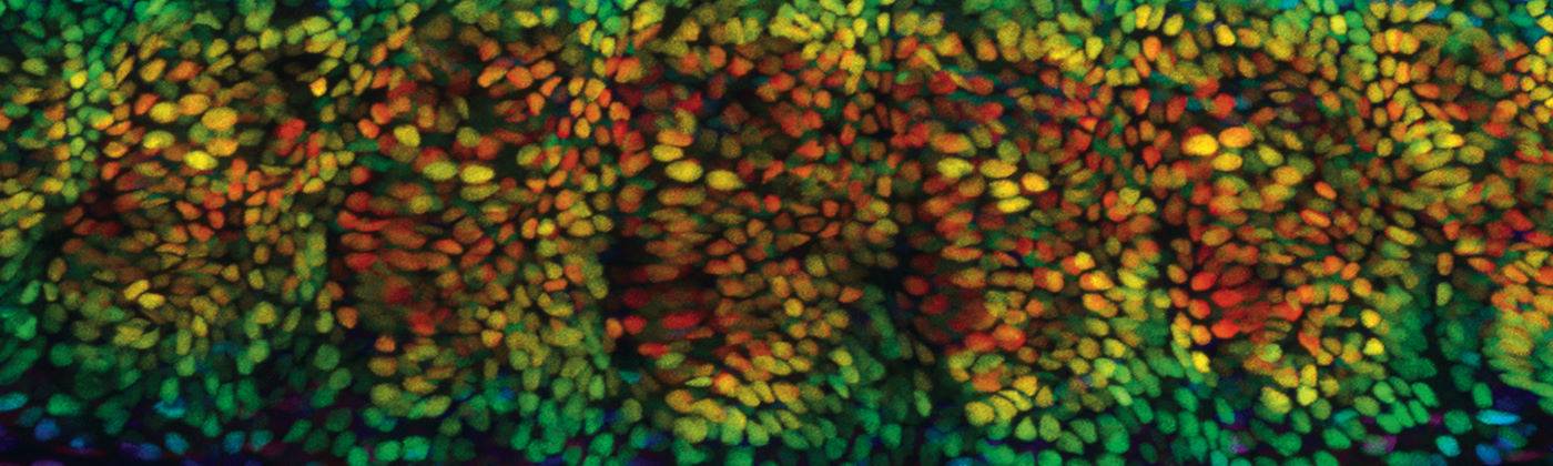 Lung tissue - red and orange in the centre, then yellow, green and blue at the fringes