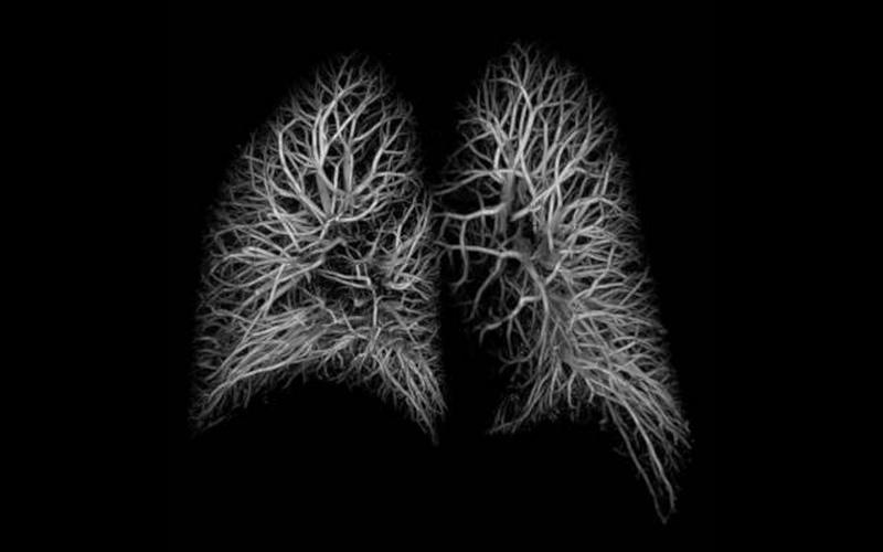 Outline of the lungs / respiratory system against a black background