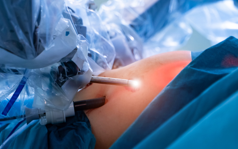 Robotic surgery is safer and improves patient recovery time | News - UCL – University College London