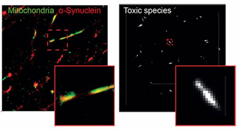 Super resolution image of α-synuclein in mitochondria of neuron (left) and single molecule TIRF image of individual α-synuclein aggregates (right). Credit: Mathew Horrocks