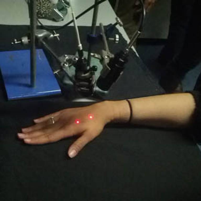 Image of a similar experiment where the hand was stimulated by 'pinprick' laser pain pulses