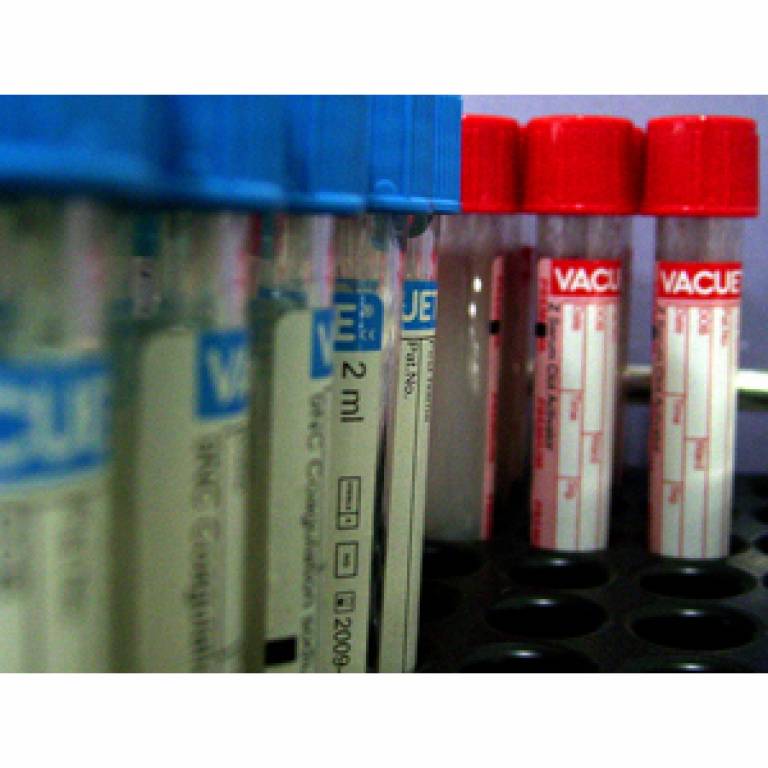 Blood samples by Chandra Marsono