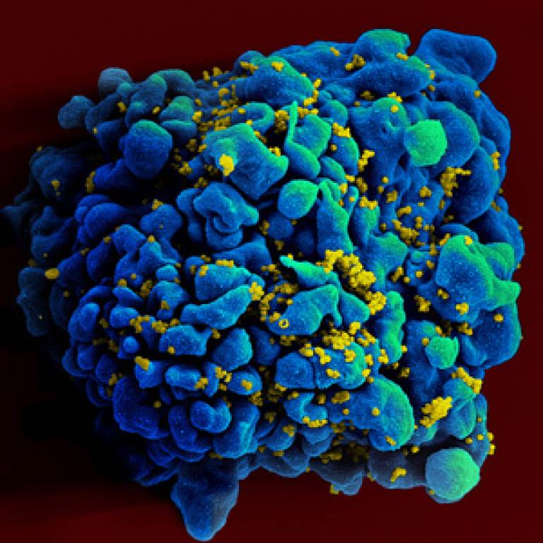 Scanning electromicrograph of an HIV-infected H9 T cell