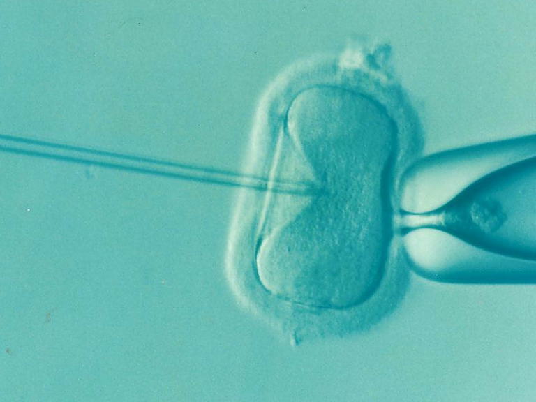 Assisted reproductive technology