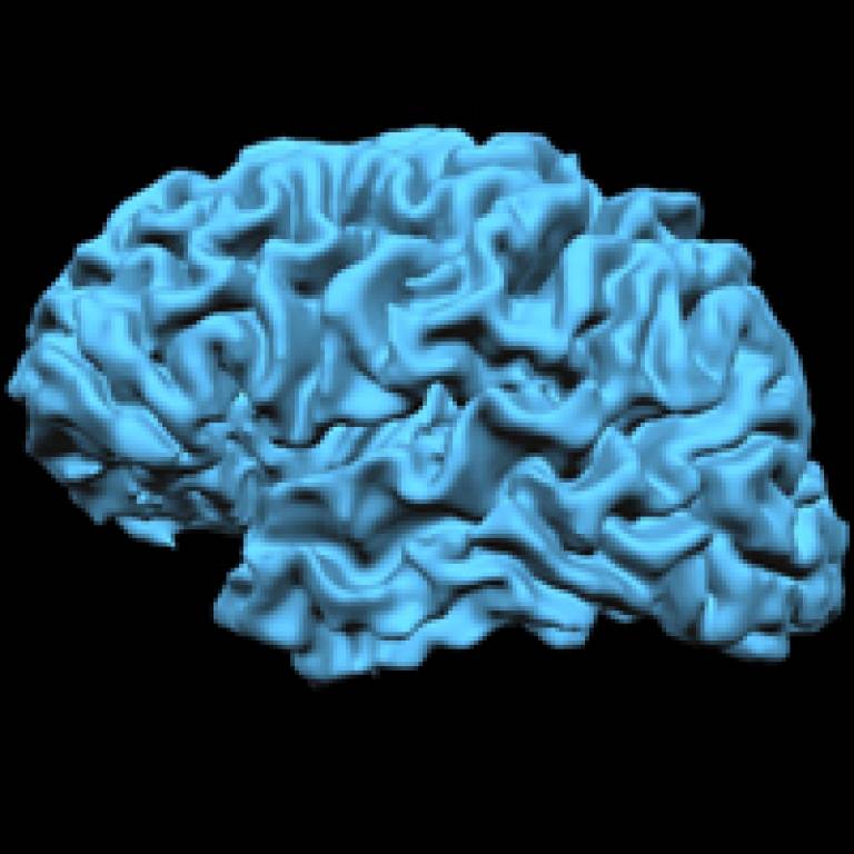Mark Lythgoe's own MRI brain scan