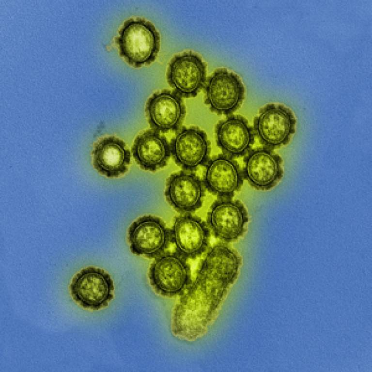 H1N1 influenza virus particles shown in transmission electron micrograph