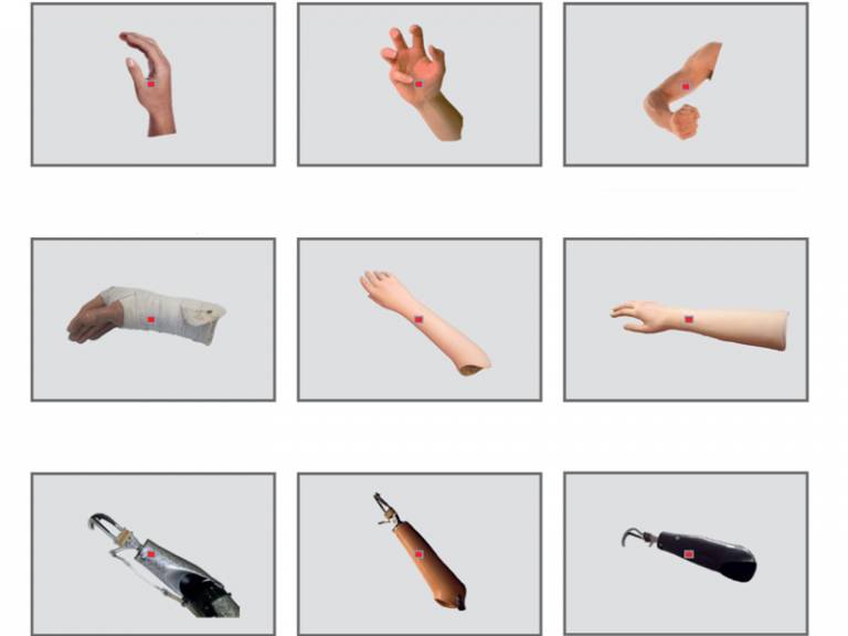 Prosthesis and hand images