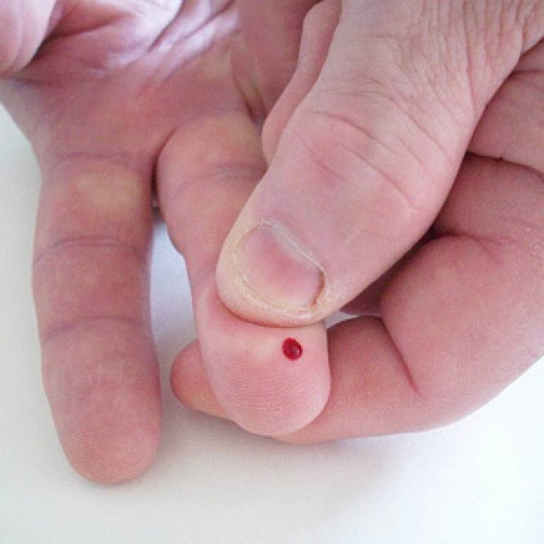 Blood tests are used to check for type 2 diabetes