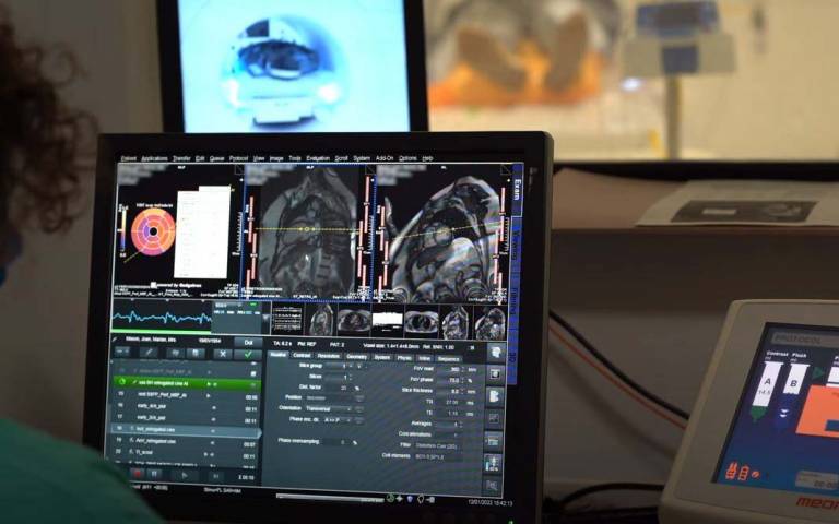 An AI tool analyses an MRI scan of a heart