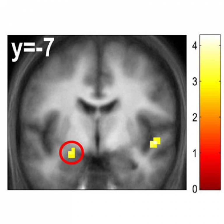Image showing the location of the effect in the amygdala