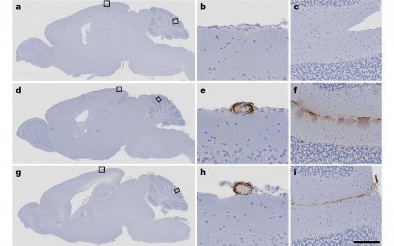 Amyloid pathology mouse brains